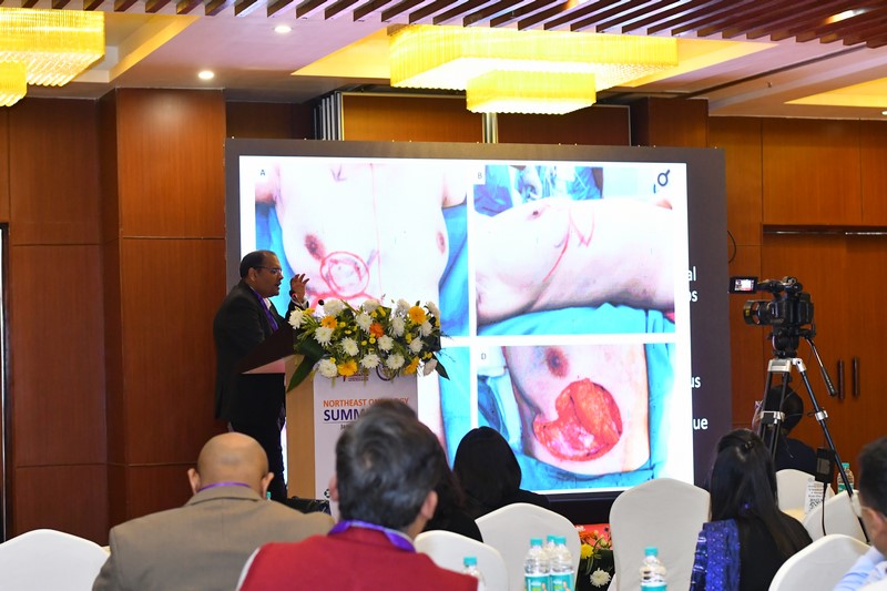 Northeast Oncology Summit (NEOS) 2024 – Dibrugarh Edition
