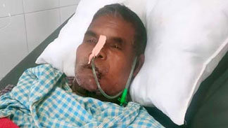 Delivery of Cancer Care in Hinterlands - A Positive Beginning Delivery of Cancer Care in Hinterlands - A Positive Beginning