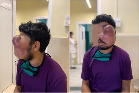 Cancer Care at ACCF - Hope Is Real!