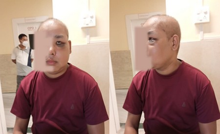 Cancer Care at ACCF - Hope Is Real!