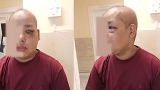 Comprehensive Cancer Treatment – delivering commitment Comprehensive Cancer Treatment – delivering commitment